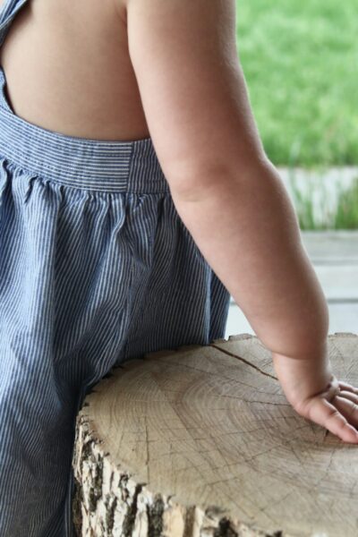 Gyermekkori elhízás