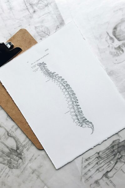 Edzés gerincsérvvel – mit szabad és mit tilos?