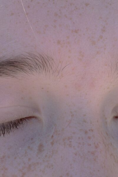 Az alacsony vércukorszint tünetei és megoldásai