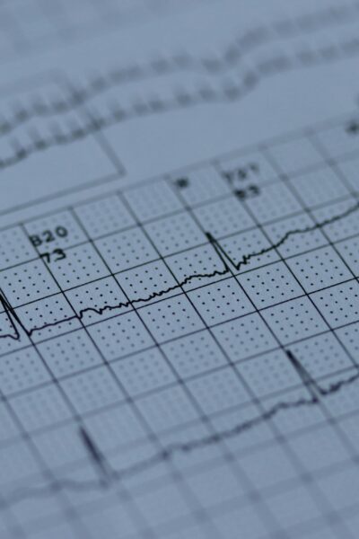 MI a zsírégető pulzus