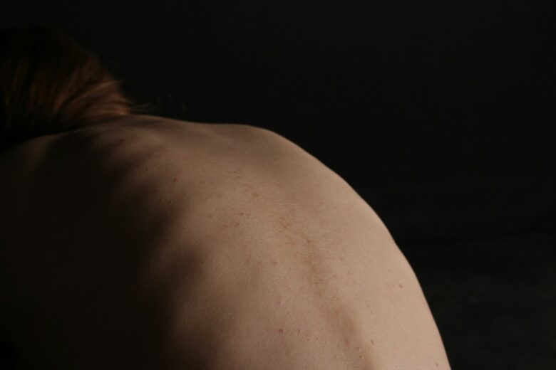 Gerincferdülés és idegbecsípődés