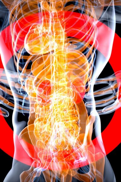 Derékfájás, lumbágó vagy isiász? Mi a megoldás?