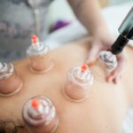 Kinesio tape, köpölyözés, flossing – Mikor használd ezeket?