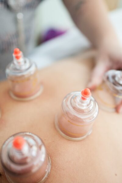 Kinesio tape, köpölyözés, flossing – Mikor használd ezeket?