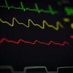 Terheléses EKG vizsgálat