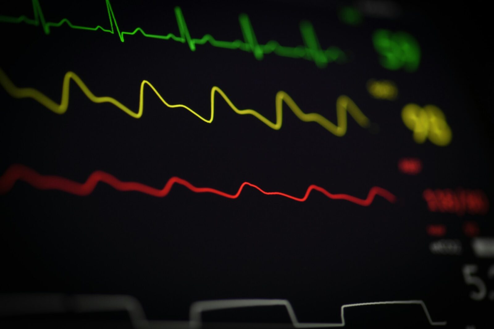 Terheléses EKG vizsgálat