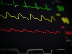Terheléses EKG vizsgálat