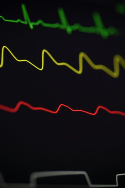 Terheléses EKG vizsgálat