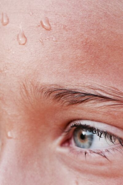 Fej és arcizzadás - így tehetsz ellene